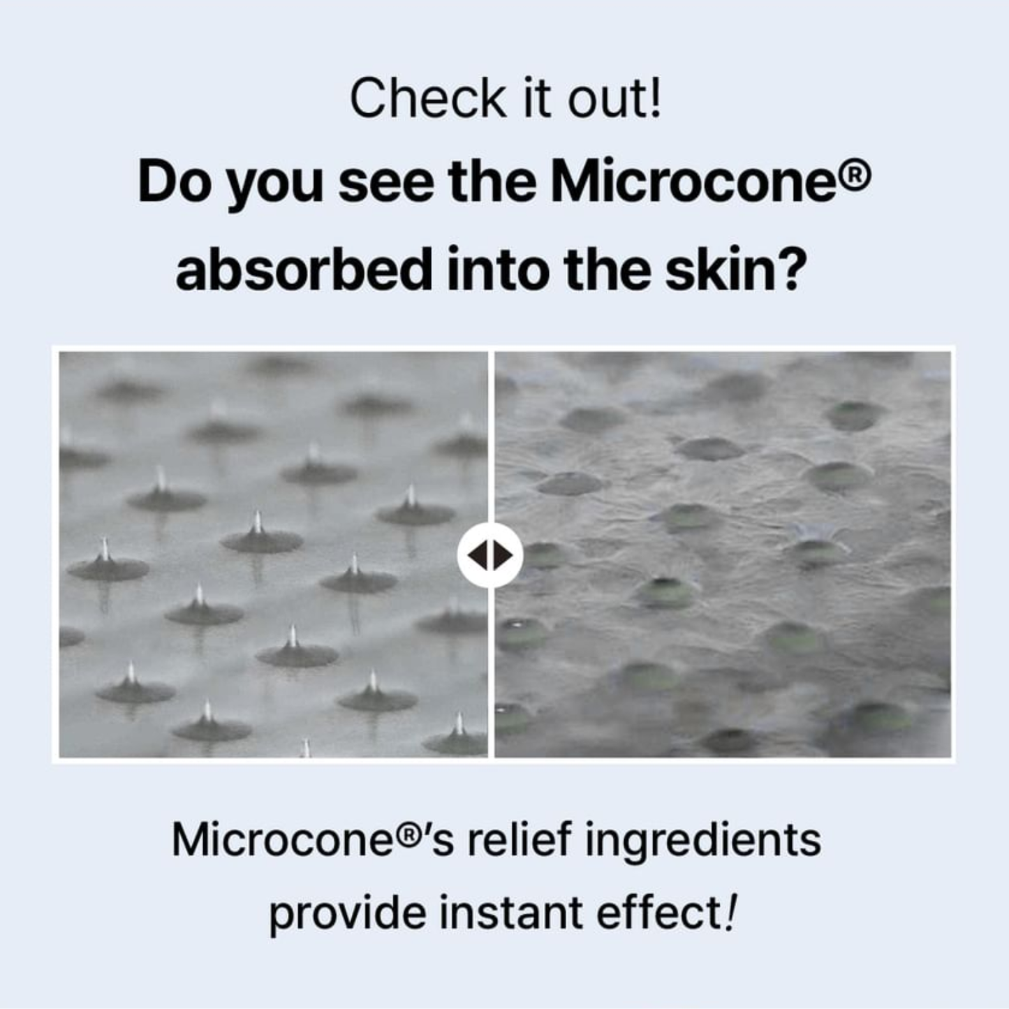 ACROPASS Trouble Care Microcone Patch Set