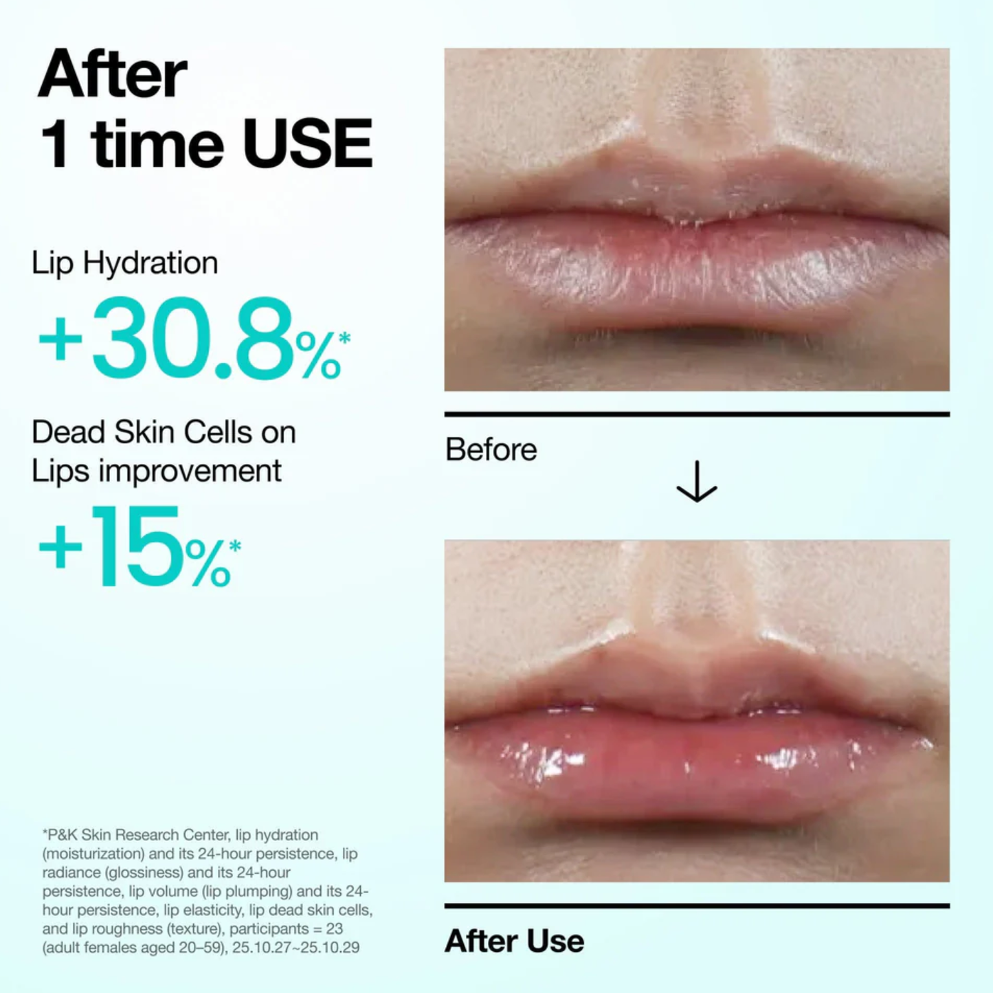 ANUA PDRN Lip Serum 10ml