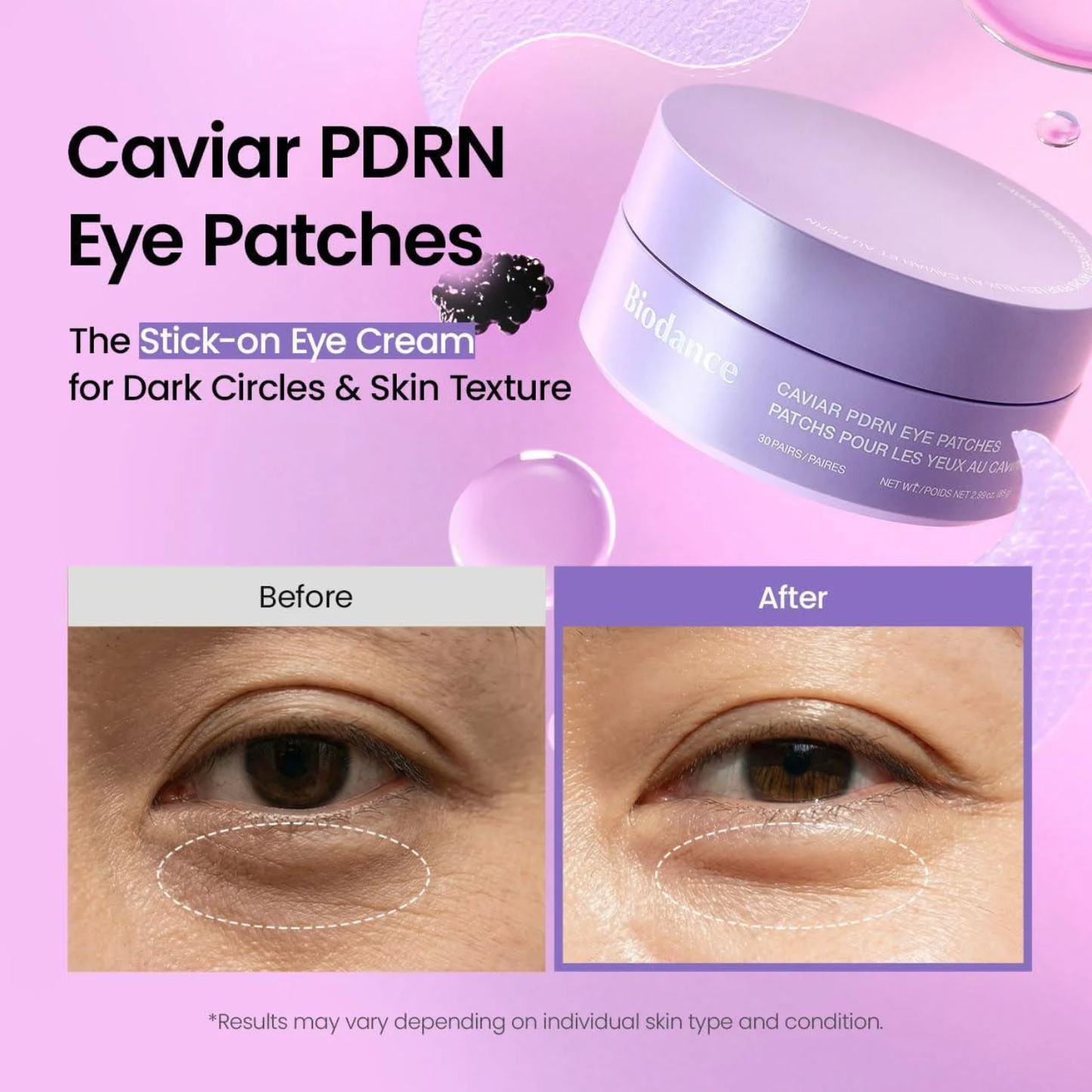 BIODANCE Caviar PDRN Eye Patches 60ea