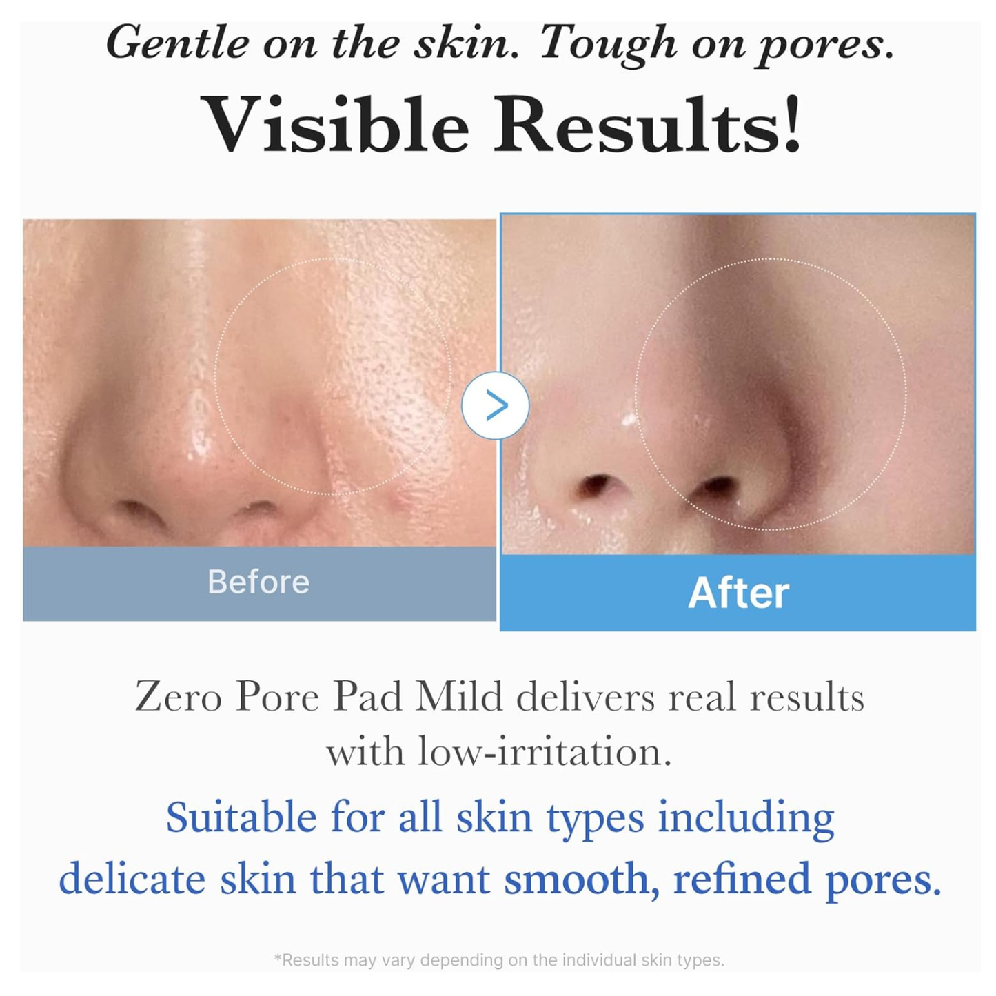 MEDICUBE Zero Pore Pad Mild 70ea